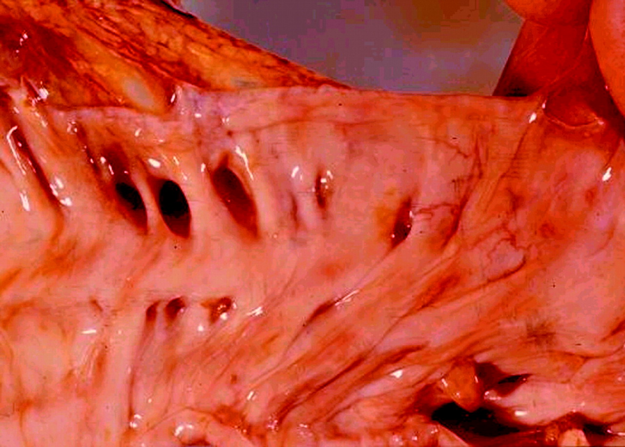 diverticulitis bpc 157 Management of Rooster Booster Liquid B-12